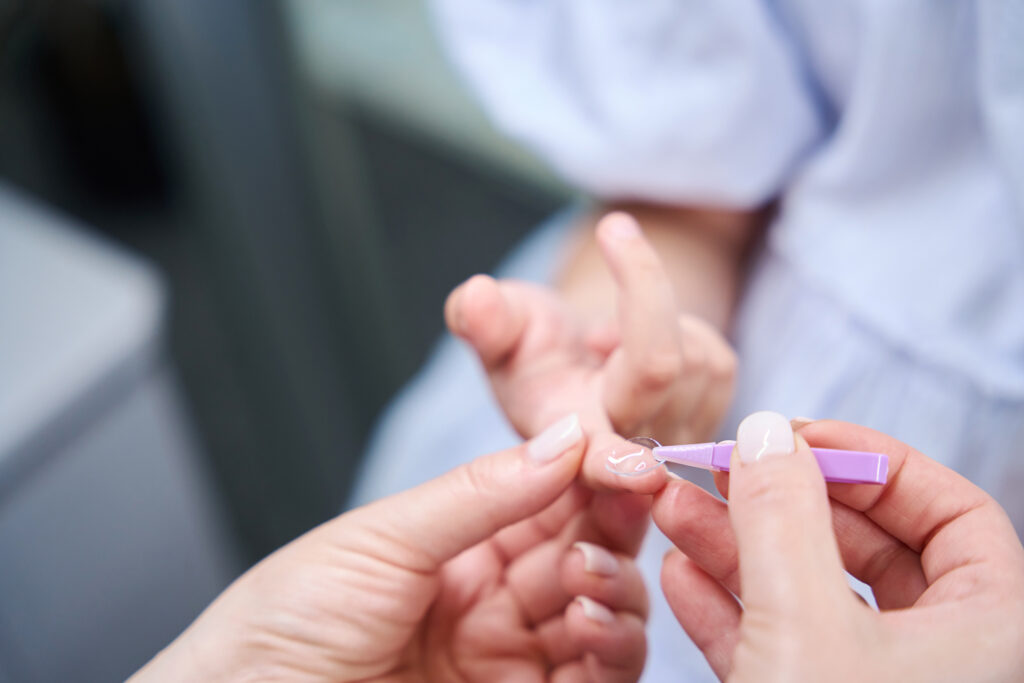 Oculist hands pinching contact lens on pediatric patient fingertip with tweezers